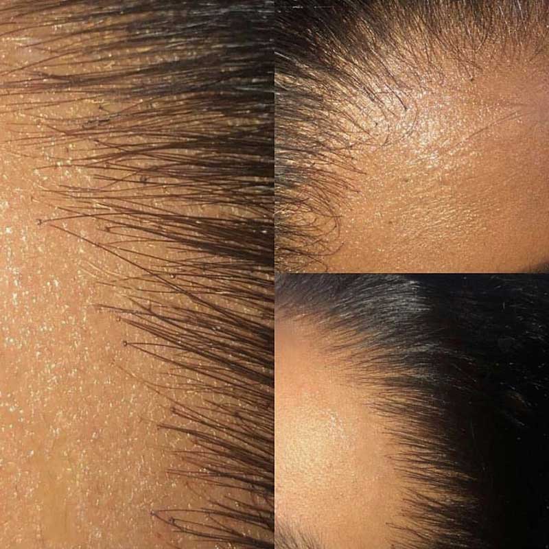 HoomyHair Silky Straight 13x4 HD Lace Front Wig Undetectable Skin Melt Human Hair Lace Wig